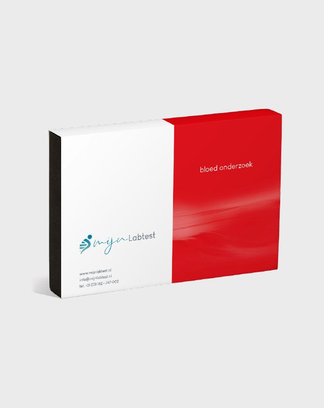 Voedsel Intolerantietest Plus